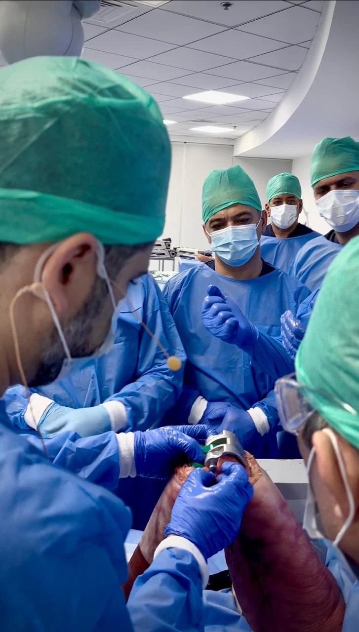 Real operating theatre photograph of knee surgery supplied by Prof. Dr. Sammy Hanna